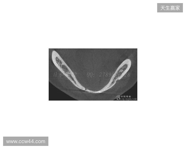 韦林顿确诊上唇部贯通伤；11、21牙半脱位；上颌前牙区牙槽骨骨折